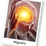 migraña