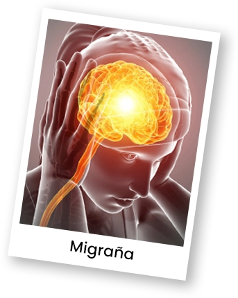 migraña